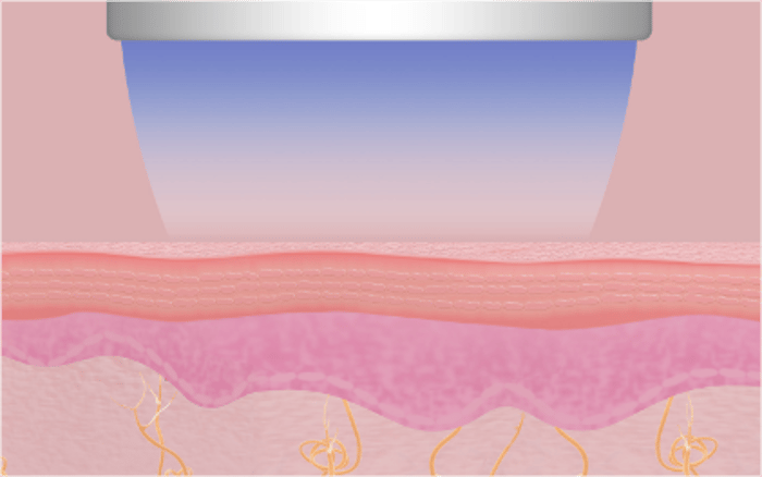 Schritt 1 – Kontakt zur Haut