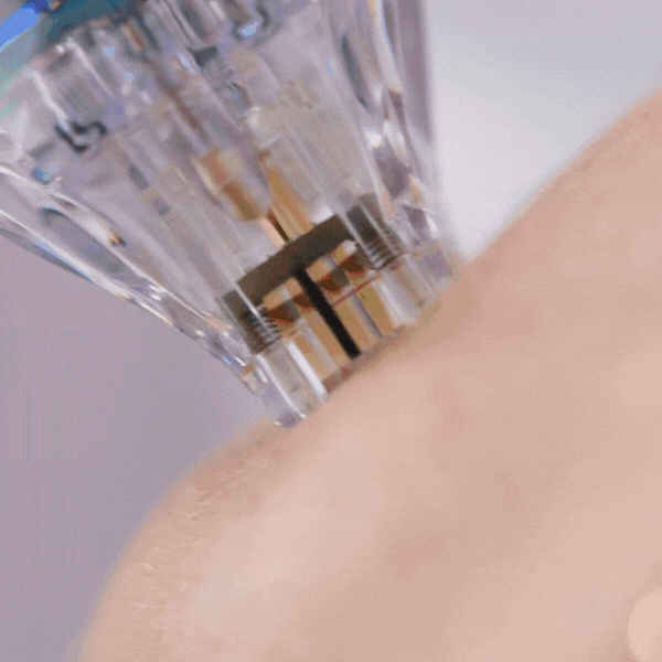 Secret RF – Handstück / Display