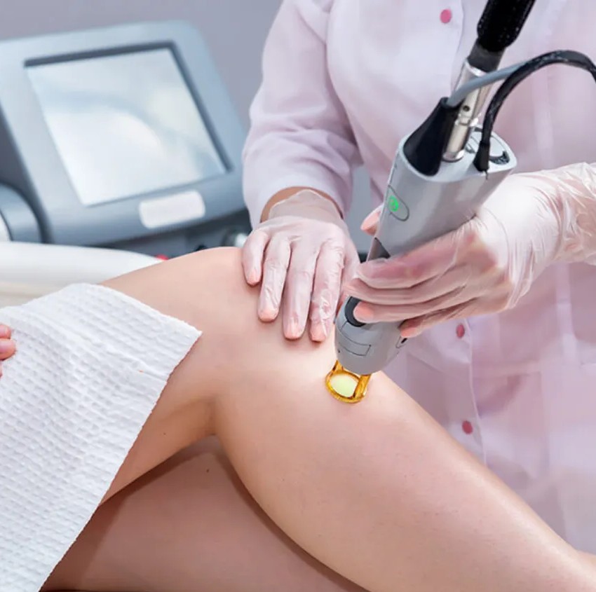 Laser Haarentfernung Jena