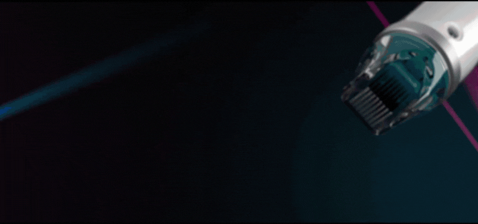 Microneedling RF Modus – Secret DUO in Jena